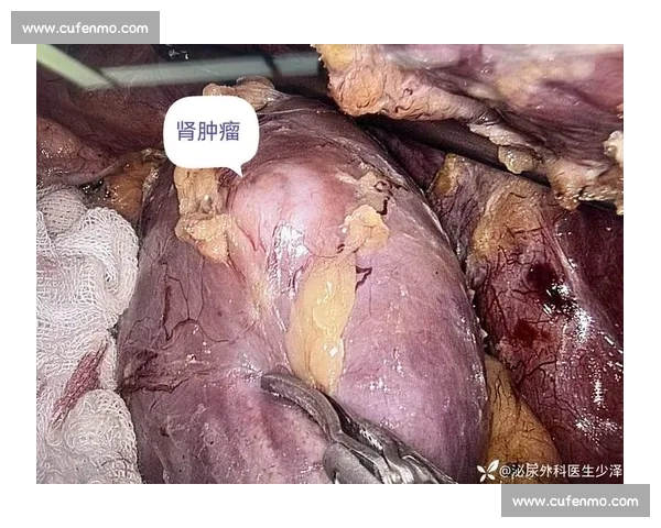 从肾癌病房到商业帝国:韦德如何用三重身份重塑人生 从肾癌病房到商业帝国:韦德如何用三重身份重塑人生
